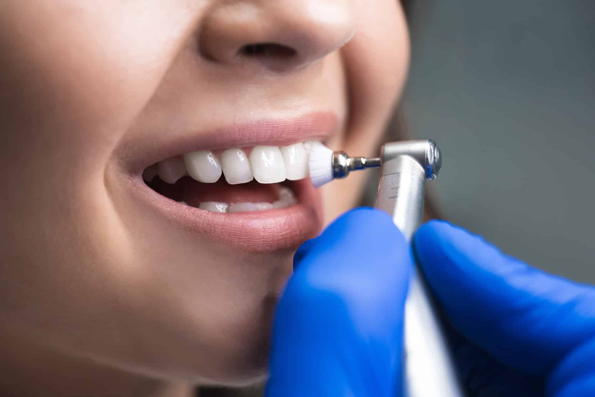 Woman getting her teeth cleaned in Lindenhurst IL