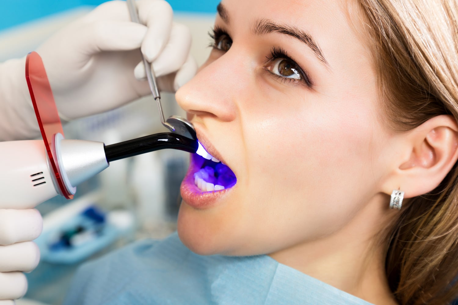 Dentist using a blue curing light to harden tooth-colored composite bonding on a woman's front teeth in Lindenhurst IL